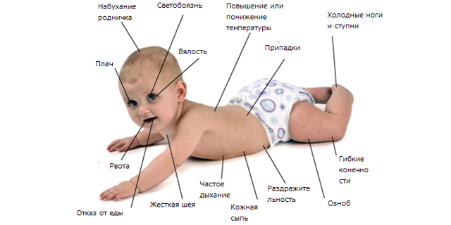 Менингит у новорожденных детей, симптомы и последствия