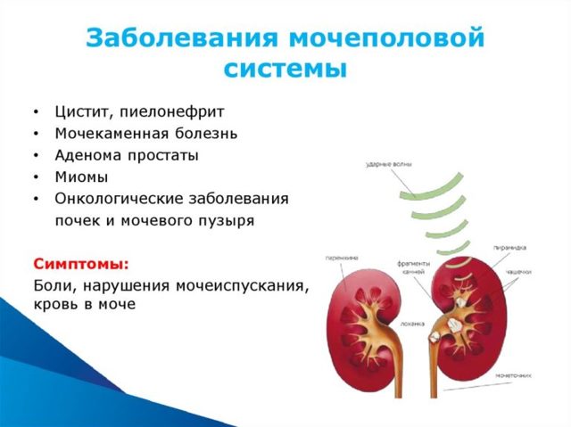 Покалывание в районе пупка