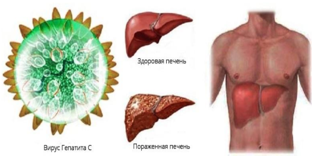 Передается ли гепатит С через поцелуй с носителем: каков риск заразиться