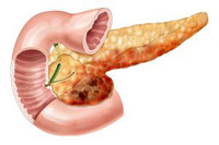 Обезболивающие при панкреатите поджелудочной железы: как быстро снять боль, обезболивание приступов