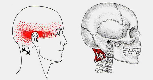 Нарушение мозгового кровообращения - причины, признаки и симптомы