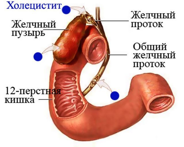 Масло оливковое при холецистите