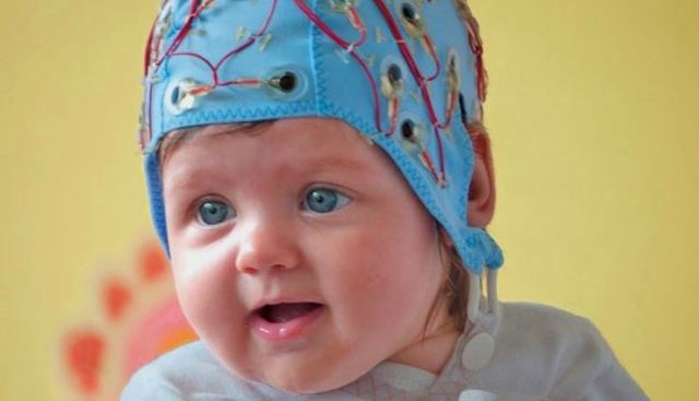 ЭЭГ (электроэнцефалограмма) головного мозга ребенку