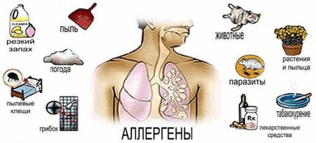 Аллергическая астма: симптомы и лечение