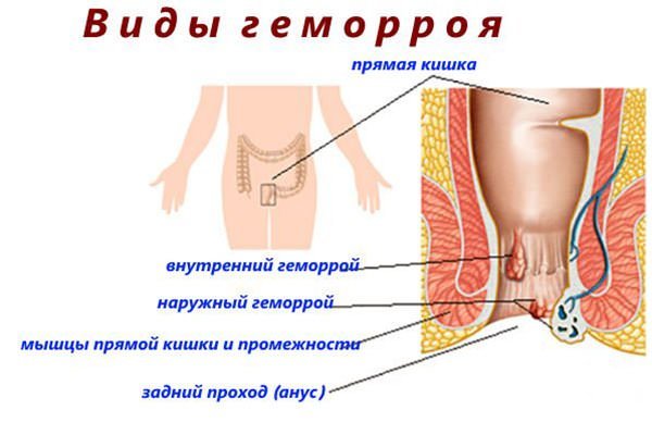 РЕЛИФ и РЕЛИФ АДВАНС: что лучше и в чем разница (отличие составов, отзывы врачей)