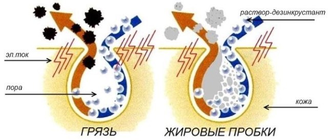 Почему появляются прыщи на голове в волосах?