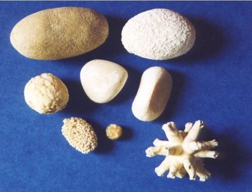 Камень в почке: какие анализы сдавать для определения типа камня.