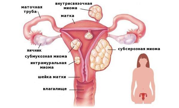 Белые точки на половых губах и влагалище