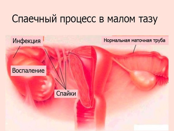 Боли внизу живота при переохлаждении: причины, симптомы и методы лечения