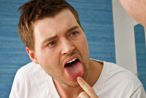Кандидоз полости рта у взрослых: причины и лечение, симптомы молочницы слизистой рта