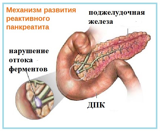 Панкреатит у детей: причины, первые признаки и лечение