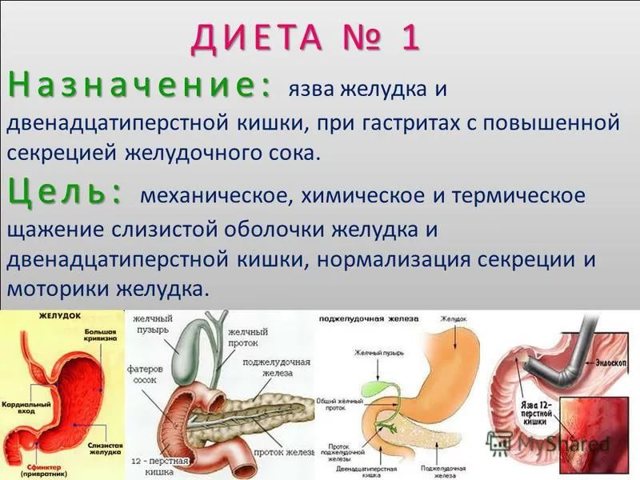 Диета при язве двенадцатиперстной кишки - что можно есть, рецепты