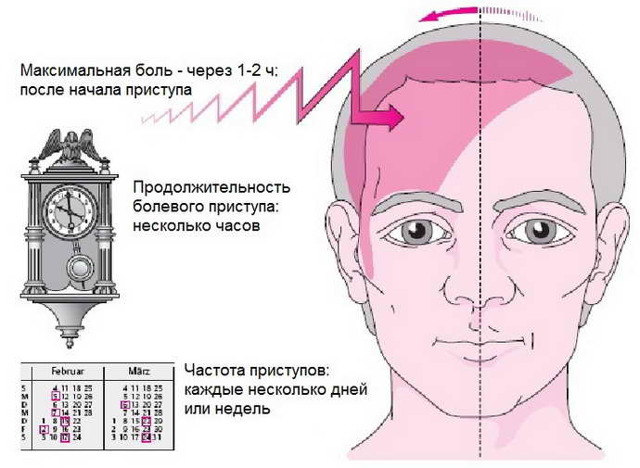 Почему рвота при мигрени - Симптомы и лечение болезней