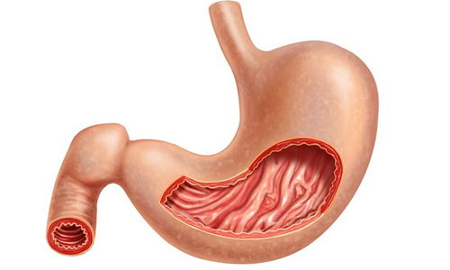 Что такое гиперплазия желудка антрального отдела желудка