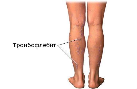 Немеет левая нога: причины и лечение недуга