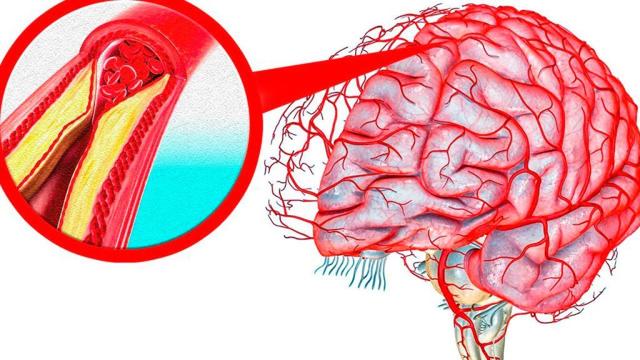 Как укреплять сосуды головного мозга народными средствами и лекарственными препаратами?