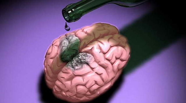 Атрофия головного мозга: виды, причины, симптомы, лечение