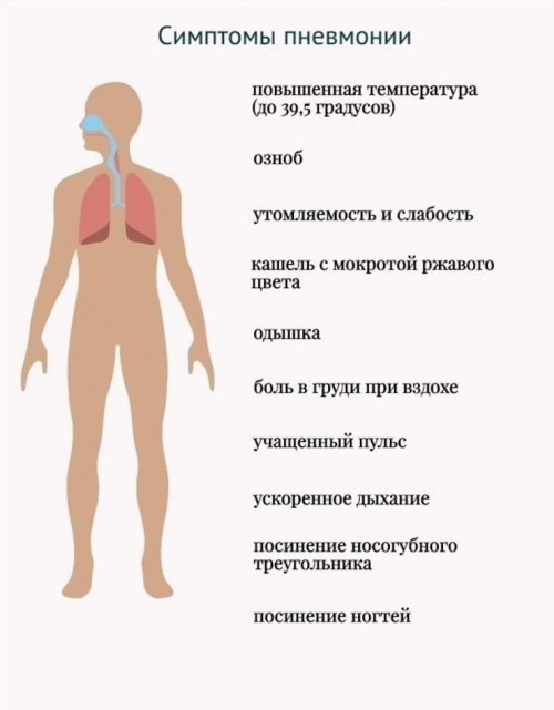 Тошнота после гриппа: остаточное явление или симптом осложнения