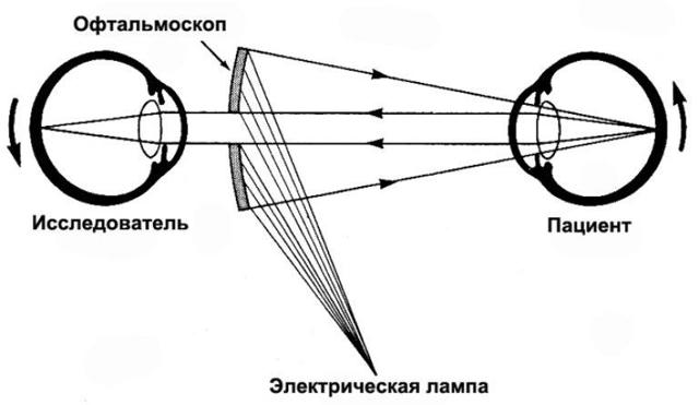 Как и для чего проверяют глазное дно?