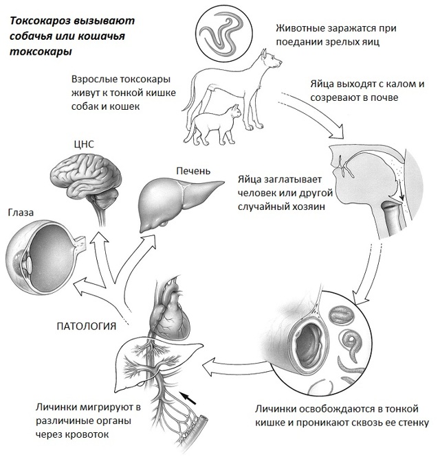 Токсокароз лечение у человека