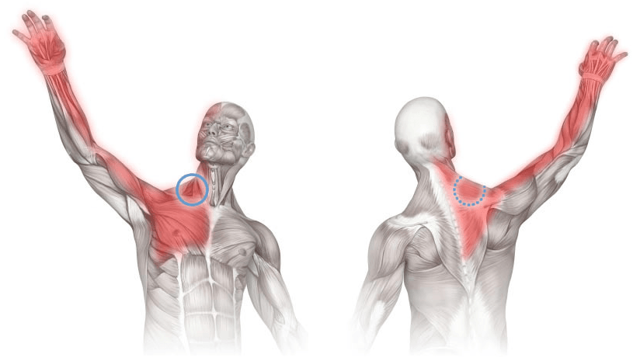 Массаж триггерных точек грудино-ключично-сосцевидной мышцы