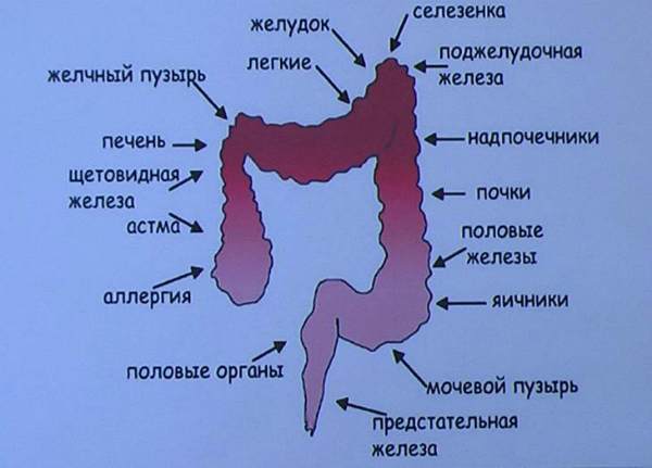 Что можно использовать вместо клизмы в домашних условиях