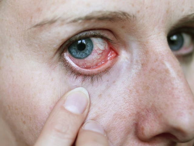 Болит глазное яблоко: причины и методы лечения