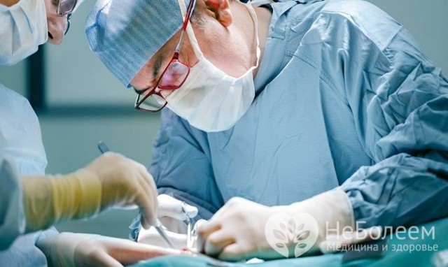 Удаление геморроя: хирургическим путем и без операции