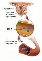 Дикловит свечи при простатите