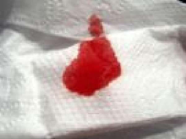Кровь в кале у взрослого мужчины - основные причины, лечение