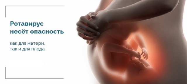 Ротавирус при беременности опасность на ранних сроках, как лечить, последствия