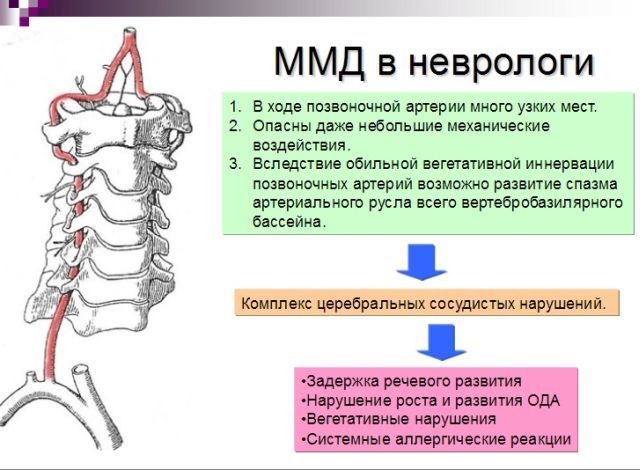 Дисфункция срединных структур головного мозга