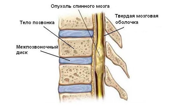 Боль в шее с правой стороны: причины, диагностика, лечение