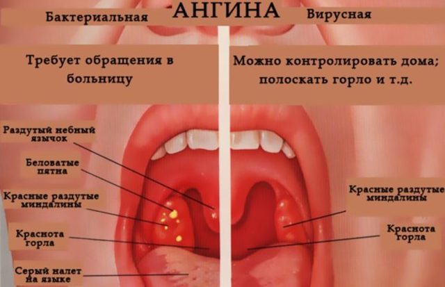 Неприятный привкус во рту: причины, виды, лечение