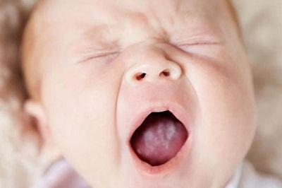 Молочница у новорожденных младенцев и грудничков во рту на языке: симптомы, лечение, эффективные средства, как выглядит