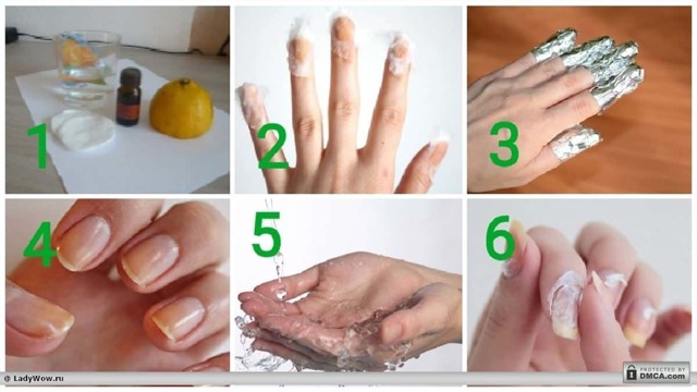 Йод для ногтей: мазать в чистом виде или добавлять в ванночки?