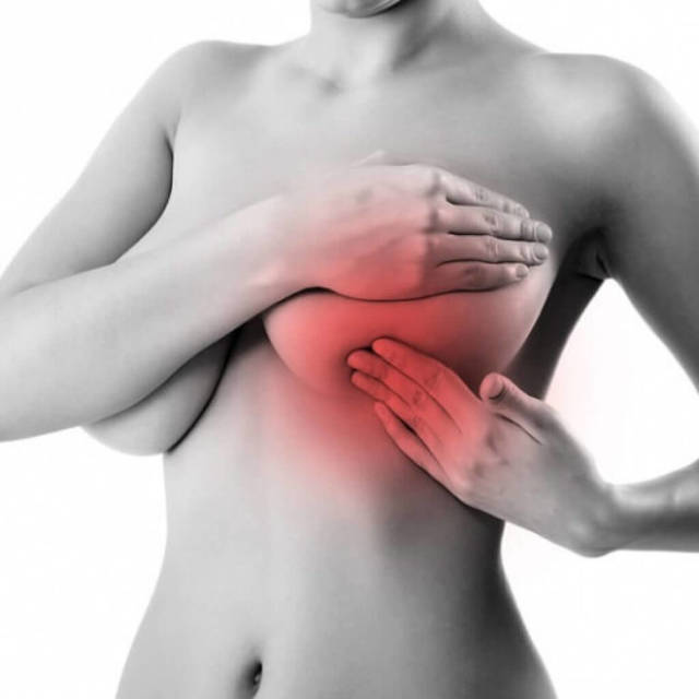 Набухла грудь: причины, признаки и способы лечения