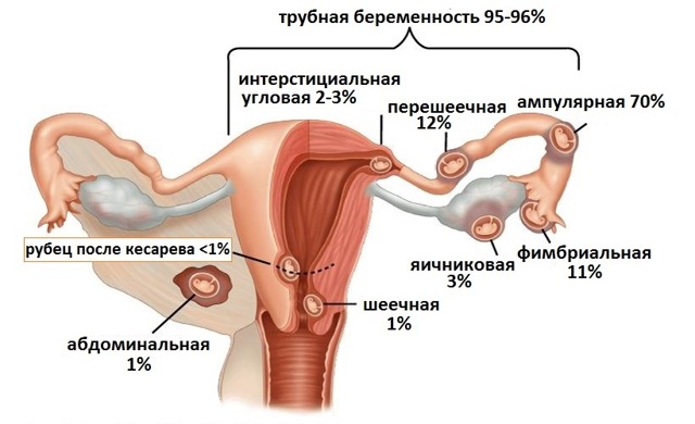 Режущая боль в желудке: что делать при резях, причины и лечение заболеваний