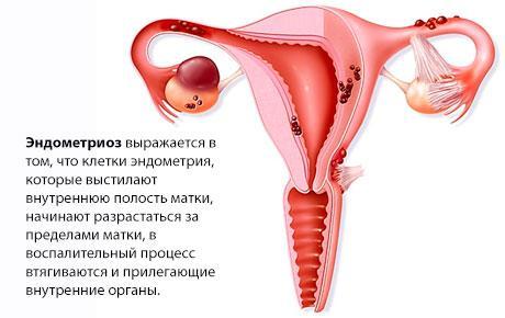 Печет внизу живота у женщин причины