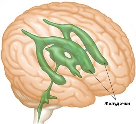 Желудочки головного мозга, их месторасположение и строение