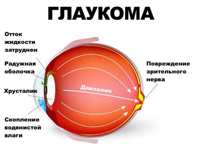 Как и для чего проверяют глазное дно?