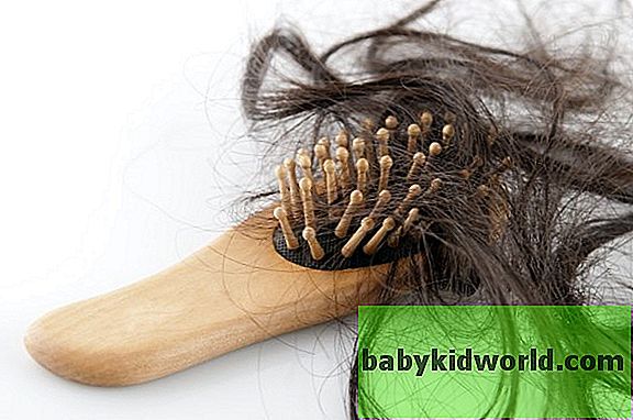 Причины выпадения волос: почему выпадают волосы на голове?