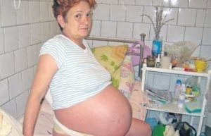 Рвота после месячных может ли это быть беременность