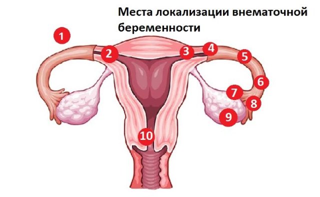 Кровянистые и коричневые выделения как признак беременности