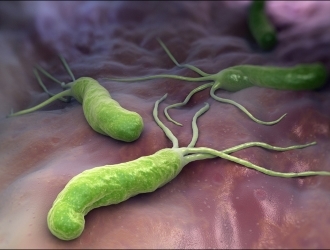 Как лечить хеликобактер пилори народными средствами - лечение бактерии травами