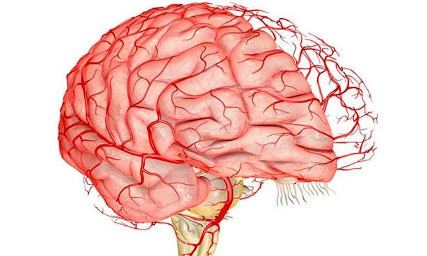 Цереброваскулярная болезнь сосудов головного мозга: лечение и прогноз