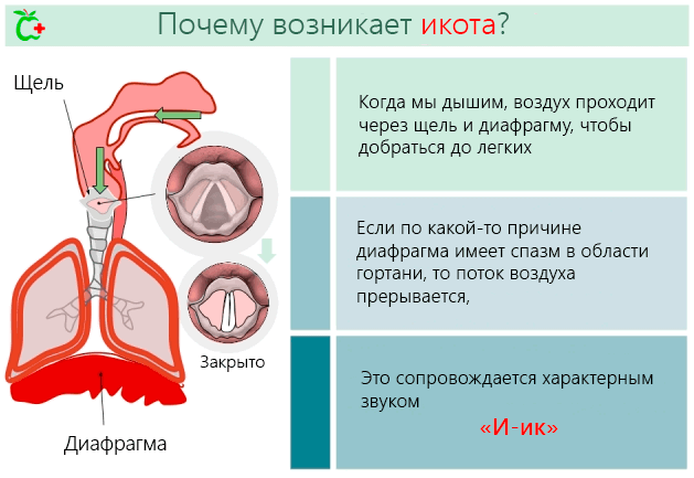 Почему человек икает: причины у взрослых и как остановить