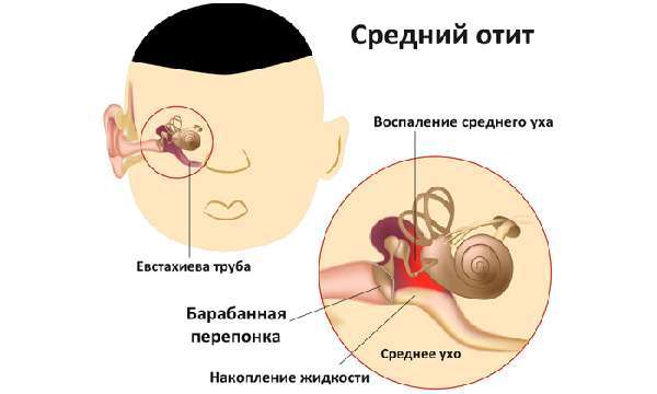 Невралгия ушного узла: причины, диагностика, лечение