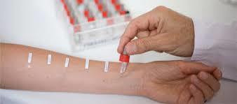 Анализ крови на аллергены: показатели и расшифровка