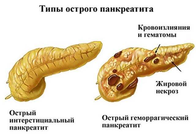 Режущая боль в желудке: что делать при резях, причины и лечение заболеваний